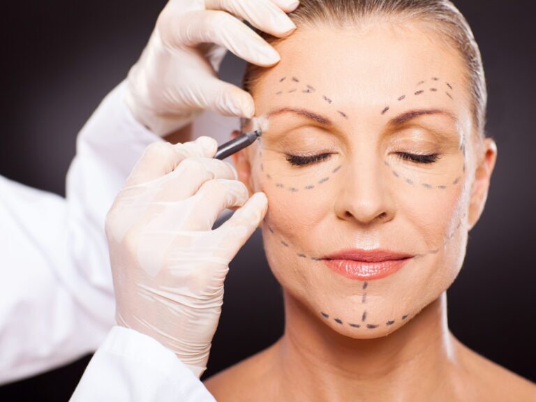 Face Surgery at Dr. Sof in Cheshire & Lancashire