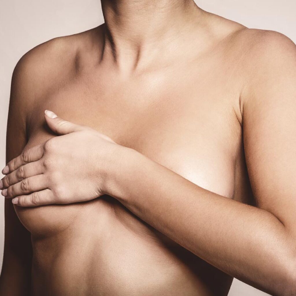 Nipple Reduction with Dr.Sof in Cheshire